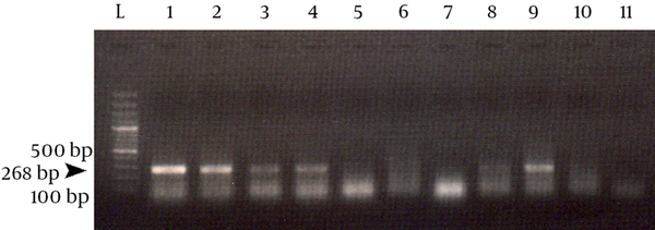 Lane L, 100 bp DNA ladder (Fermentas); lane 11, negative control contained no template DNA. 268 bp amplified DNA fragment can be seen in several lanes (e.g. lanes 1, 2, 3, 4) and not in lanes 5, 6, 7.