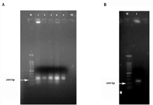 (A) Electrophoresis of PCR products on 1% agarose gel, Arrow shows band 200 bp and the fragment can be seen on top of it. (1-5: PCR products and M: Marker VC 100 bp Plus and NC, negative control), (B) the PCR product extracted from a 1% agarose gel. Arrow shows band 200. (M: MarkerVC 100 bp plus, 1: One of the products extracted from the gel)