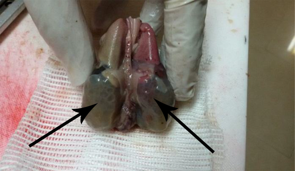 Coudal Appearance of Viscera of Fetus Indicating Polycystic Large Kidneys
