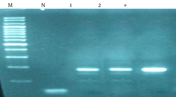 (+), Positive control; (N), negative control; lanes 1 and 2, clinical samples; M, DNA molecular weight marker. DNA extracted from tissues was amplified with specific primers. Amplification of fragment yielded a band of 167 bp.