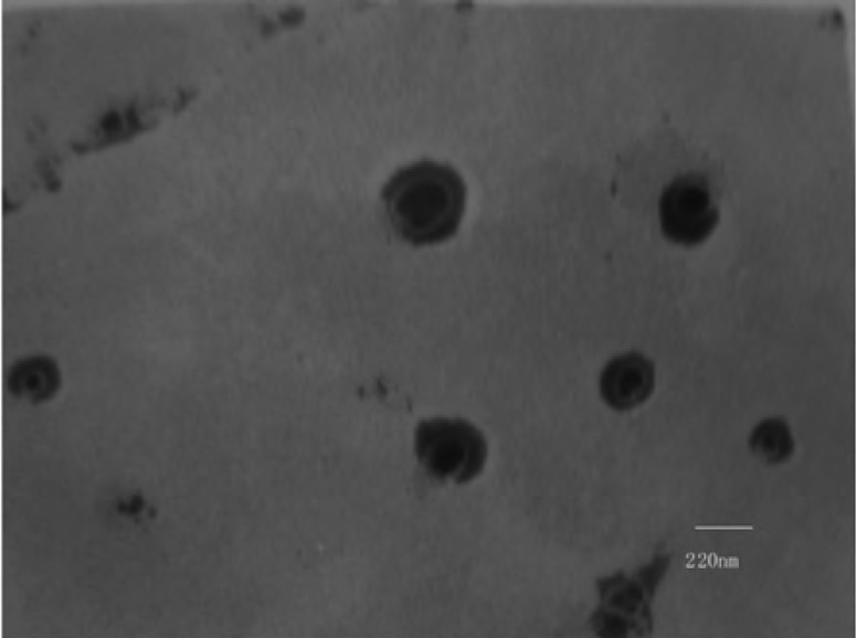 Transmission electron photograph of Cefquinome Sulfate liposome