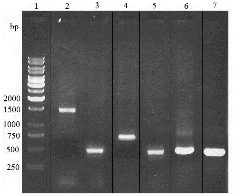 PCR analysis of genomic DNA from zeocin/blasticidin-resistant Sp2.0 cells. PCR products were electrophoresed on a 1% agarose gel. Lane 1, 1kb DNA markers; lane 2, amplification of heavy chain gene from DNA of resistant Sp2.0 cells; lane 3, amplification of variable region of heavy chain gene from DNA of resistant Sp2.0 cells; lane 4, amplification of light chain gene from DNA of resistant Sp2.0 cells; lane 5, amplification of variable region of light chain gene from DNA of resistant Sp2.0 cells; lane 6, amplification of variable region of heavy chain from recombinant vector pFUSE-CHIg-hG4-VH; lane 7, amplification of variable region of light chain from recombinant vector pFUSE-CLIg-hk-VL.