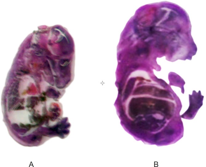 Photomicrograph of H and E- stained normal (A), metronidazole (B) mice fetus sections. The liver and brain were probed