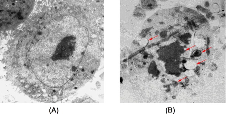 Morphology of apoptotic HeLa cells induced by baicalin observed by TEM(×6000). (A) control group, (B) high dose baicalin group.