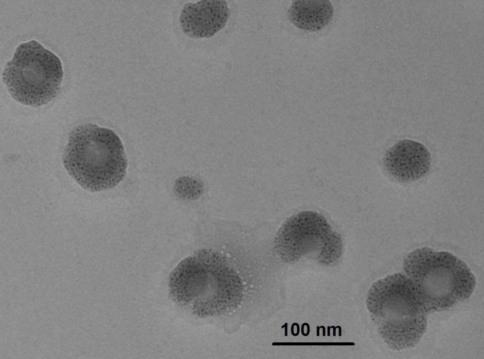 TEM image of egg albumin nanoparticles