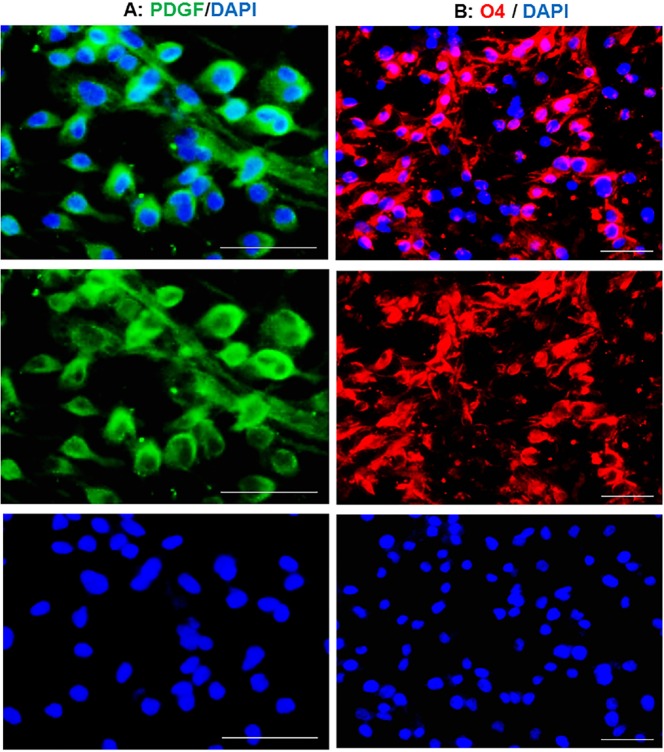 Conversion of the fate of TSA-treated human astrocytes to oligodendrocyte progenitors. The induced cells expressed PDGFR