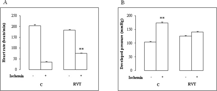 Effect of RVT on heart rate variations of isolated heart subjected to I/R injury. Heart rate was recorded before (-) and after (+) .ischemia in control (C) and RVT treated animals. Results are expressed as mean ± SEM (n=6). **p < 0.01 vs C