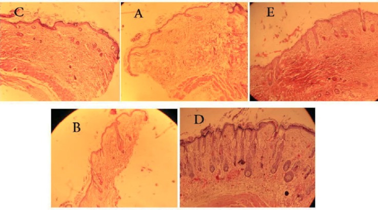 Histology of skin sections: (C) Skin of animal treated with Testosterone and vehicle, (A) Skin of animal treated with testosterone, (E) Skin of intact animal, (B) Skin of animal treated with testosterone and finasteride solution, (D) Skin of animal treated with testosterone and A. capillus veneris Linn