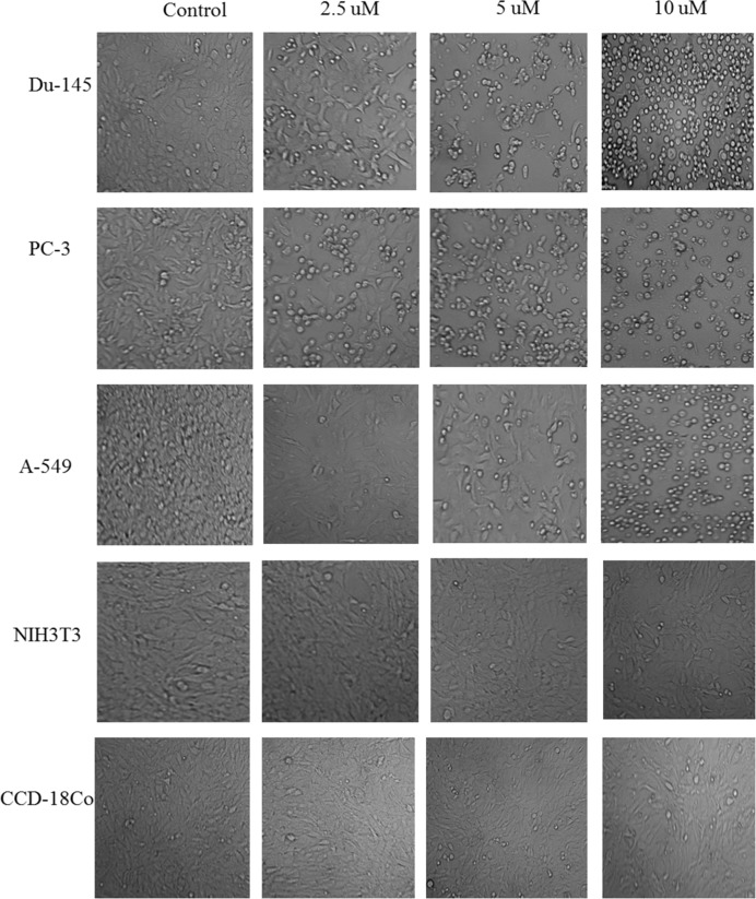 Morphological changes in selected cancer cell lines (Du-145, PC-3, A-549) and normal cell lines (NIH3T3, CCD-18Co). The cells were treated with different concentrations of nimbolide (0, 2.5, 5, and 10 uM) for 48 h and observed under phase contrast microscope (magnification 100x)