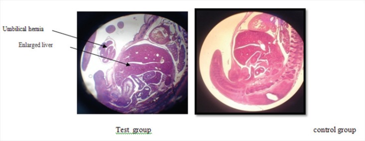 View of enlarged liver and also umbilical hernia in the test group due to the delay in the fetal development