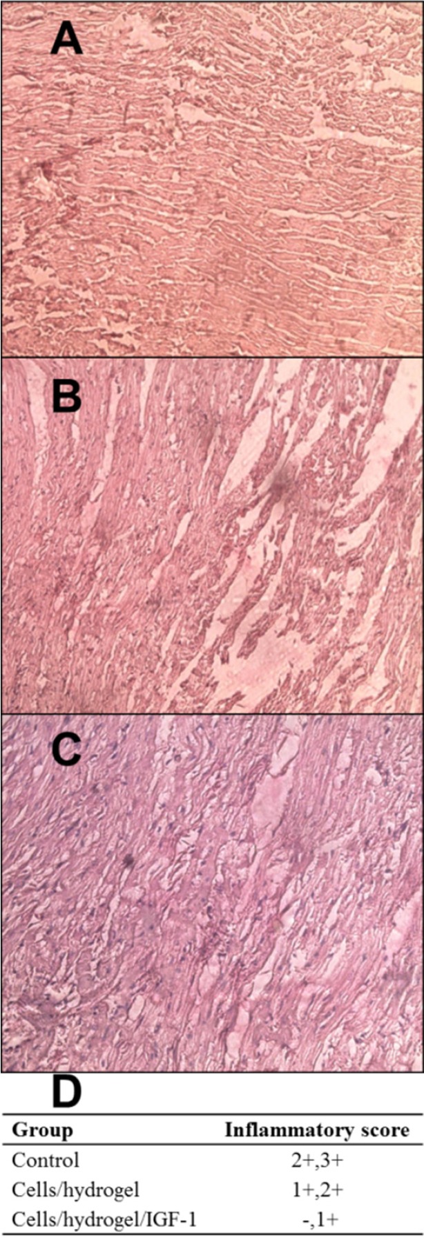 Representative images (×200) of H&E staining in the infarcted area of control (A), Cells/hydrogel (B), and Cells/hydrogel/IGF-1 (C) groups. (D) Inflammatory score in control and treated groups (n = 6