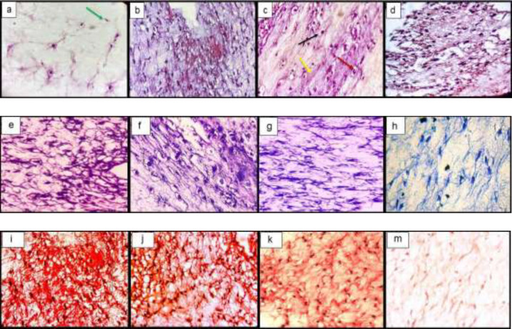 Histological sections of neo-cartilage formed by TGF-β3, KGN and ASU in fibrin scaffold cultures after 14 days as determined by H&E (a: TGF-β3, b: KGN c: ASU and d: Control), Toluidine blue (e: TGF-β3, f: KGN g: ASU and h: Control), Safranin O (i: TGF-β3, j: KGN k: ASU and m: Control) in vitro culture, magnification ×40. Green arrow: Stem cell with an elongated and fusiform nucleus. Red arrow: An isogonic group within Lacuna. Black Arrow: Chondrocytes-like cells inside the lacunae. Yellow arrow: Extracellular matrix