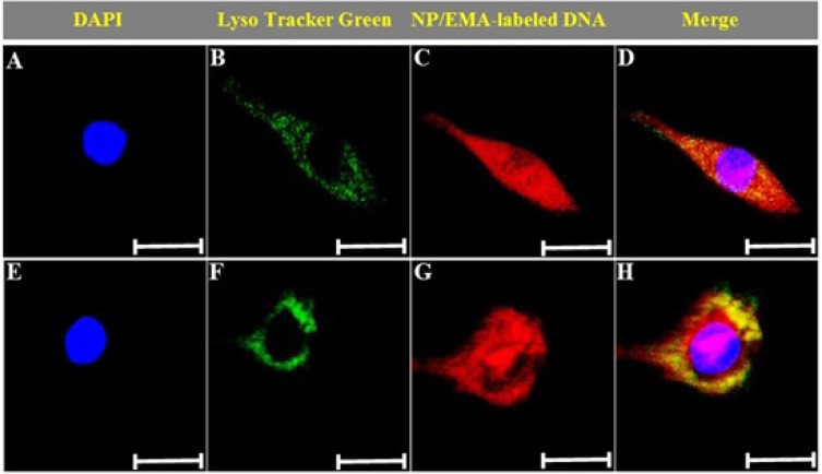 Cellular loclization of PAMAM–PEG–SRL/DNA nanoparticles. Photos were taken after cells incubated with nanoparticles for 15 min (A–D), or 60 min (E–H). Green: Lysotracker Green (B, F). Red: EMA-labeled DNA (C, G). Yellow: Lysotracker Green colocalized with EMA-labeled DNA (D, H). Bar: 10μm