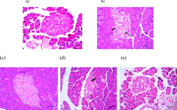 Photomicrograph of the rat's pancreas: (a) Normal appearance of cells inside the Langerhans islets, (b) cellular vacuolation (arrow) and loss of cytoplasmic tonality (arrowhead) in some cells of Langerhans islets in the untreated diabetic rats, (c) Normal appearance of endocrine pancreatic cells in Langerhans islets in the SMN-received rats, (d) MEL-received diabetic rats showing cellular depletion (thick arrow) and vacuolation (thin arrow) in cells of Langerhans islets, (e) pancreas tissue from diabetic animals, which received both test compounds, representing cellular aggregation in Langerhans islets which is more than MEL-received group and lesser than the control group. H&E (100 X) and scale bars = 25 µM