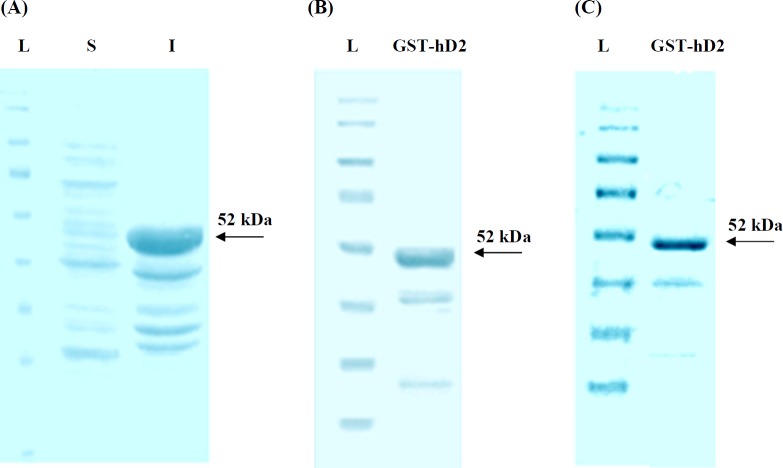 SDS-PAGE analysis of the synthesized human anti-TNF-α scFv expression in E. coli. (A) L, S and I represent protein molecular size marker (SM0671), supernatant and cellular debris of bacteria, respectively; 3h after induction by IPTG; (B) SDS-PAGE analysis of GST-hD2 fusion protein. The purified soluble GST-hD2 after solubilization of inclusion bodies; (C) Purified soluble GST-hD2 protein resulted from glutathione affinity purification