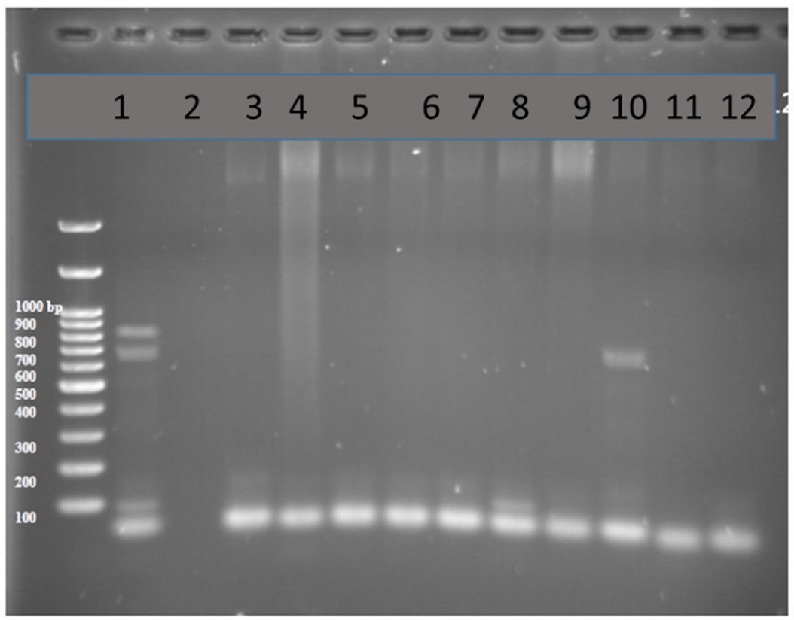 PCR products in well 1 represents two lengths of 680 bp and 643 bp as positive controls. Well number 2 represents negative control. Well number 10 contains PCR product of positive VEB encoding gene as DNA template