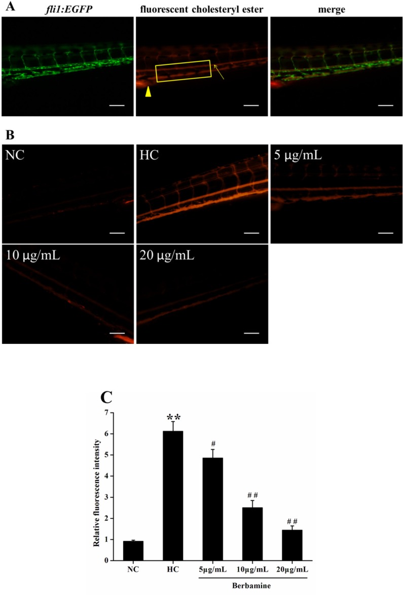 Effect of BBM on vascular cholesterol accumulation in zebrafish larvae. A: fluorescent images of fli1:EGFP zebrafish larvae. Arrow: caudal artery; triangle: cloaca. Fluorescence intensity was measured from the cloaca (outlined by rectangle). B: fluorescent images of the caudal artery from tested groups. Lateral views, dorsal is up. C: relative fluorescence intensity of the caudal artery. NC: normal control; HC: high-cholesterol. Values were means ± SE, n = 10 in each group. **p <0.01 vs. NC group; #p <0.05, ##p <0.01 vs. HC group. Scale bars: 100 μm