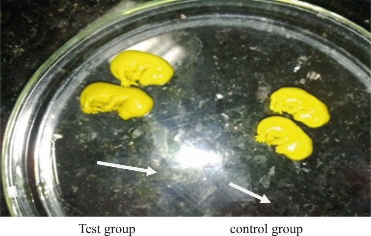 Comparison of the correct rotation of fetus and the CR in both test and control groups