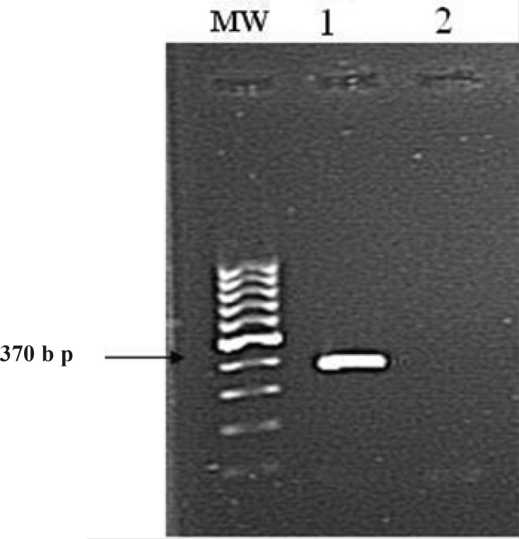 Amplification of 16S rRNA gene of isolated strain ISPC2 with universal primers RW01 and DG74