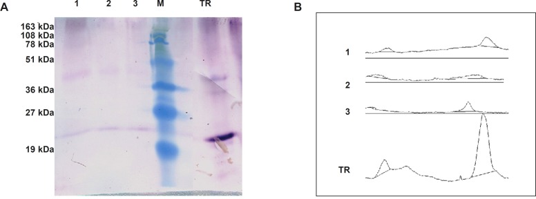 Estimation of TRAIL production by Semi-quantitative western blot analysis. Panel (A) represents western blot analysis of 200 μg total protein extract of transformed N. tabacum cells (1,2,3) beside 1 μg of recombinant standard TRAIL (TR). Panel (B) represent corresponding area of developed bands through ImageJ software analysis.