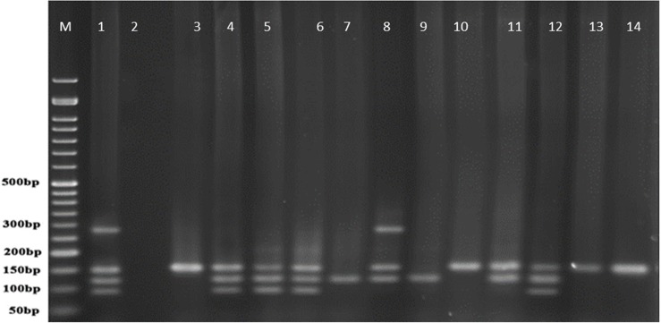 ERIC-PCR products of P. aeruginosa strains from human samples