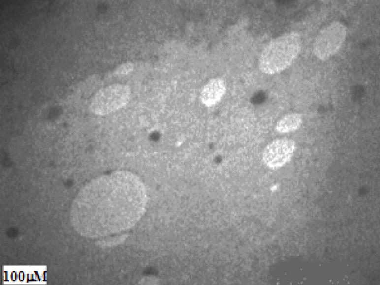Electron microscopic image of the antisense oligodeoxynucleotide-encapsulating liposome (F3).