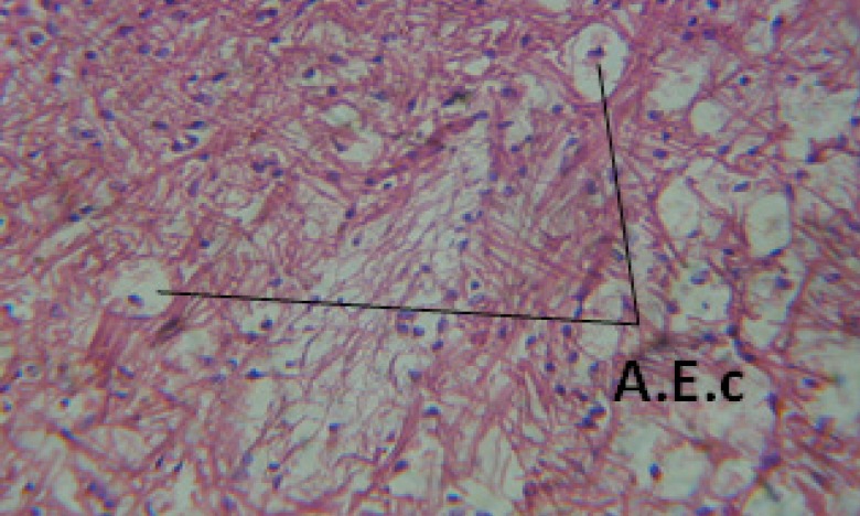 T.S. in treated B. alexandrina with 40 ppm leaves extract showing digestive epithelia. A.E.c: evacuated epithelial cells X = 200