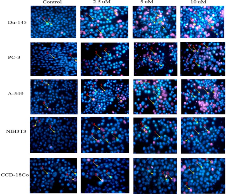 Morphological changes in selected cancer cell lines (Du-145, PC-3, A-549) and normal cell lines (NIH3T3, CCD-18Co) detected with dual staining of Hoechst 33342 and propidium iodide. The cells were treated with different concentrations of nimbolide (0, 2.5, 5, and 10 uM) for 48 h and observed under fluorescent microscope (magnification 400x). Arrows indicate (1) viable cells with normal nuclei, (2) live cells with apoptotic nuclei, (3) dead cells with normal nuclei, and (4) dead cells with apoptotic nuclei