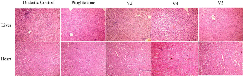 Histopathology of liver and heart on diabetic control, positive control pioglitazone, test compounds V2, V4, and V5