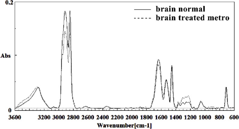 Mid-infrared spectra of normal (solid line) and Metronidazole treated (dot line) brain sections in the 600–3600 cm–1 wave number region