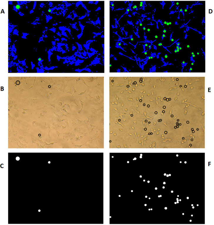 Discrimination of detached from attached cells growing on two different PDMS samples of R0 (A-C) and S2 (D-F). (A and D) Combined all categories (blue: attached cells, green: detached cells and black: medium culture). (B and E) Using the pattern originated in the previous section on the original Images to identify detached cells in the form of proportional black circles. (C and F) Display the number and size of different circles in the selected photography area