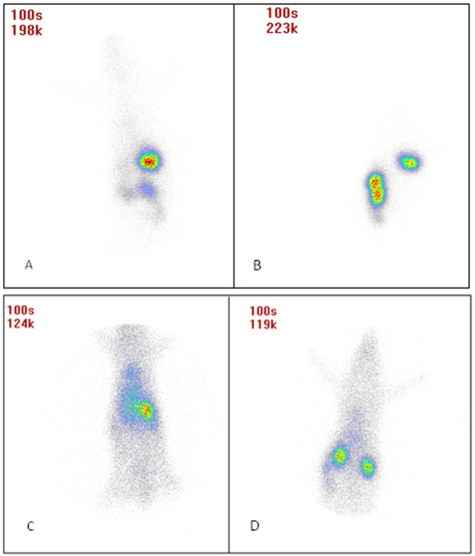 Gamma scintigraphy photographs of rats receiving (A) oral free INH after 75 min, (B) oral INH SLNs after 75 min, (C) iv free INH after 20 min, and (D) iv INH SLNs after 20 min