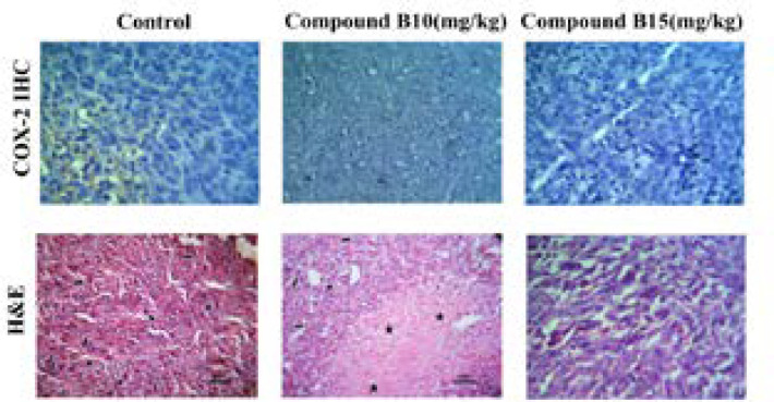 Expression of COX-2 in tumor tissues. Tumor tissues were collected from the mice receiving 10 and 15 mg/kg /day of compound B. Representative images of the immunohistochemical analysis are shown. All photomicrographs are at ×200 magnification. Small arrow: inflammatory cells; Big arrow: tumor cells; Star: necrotic area; Headache: mitotic division