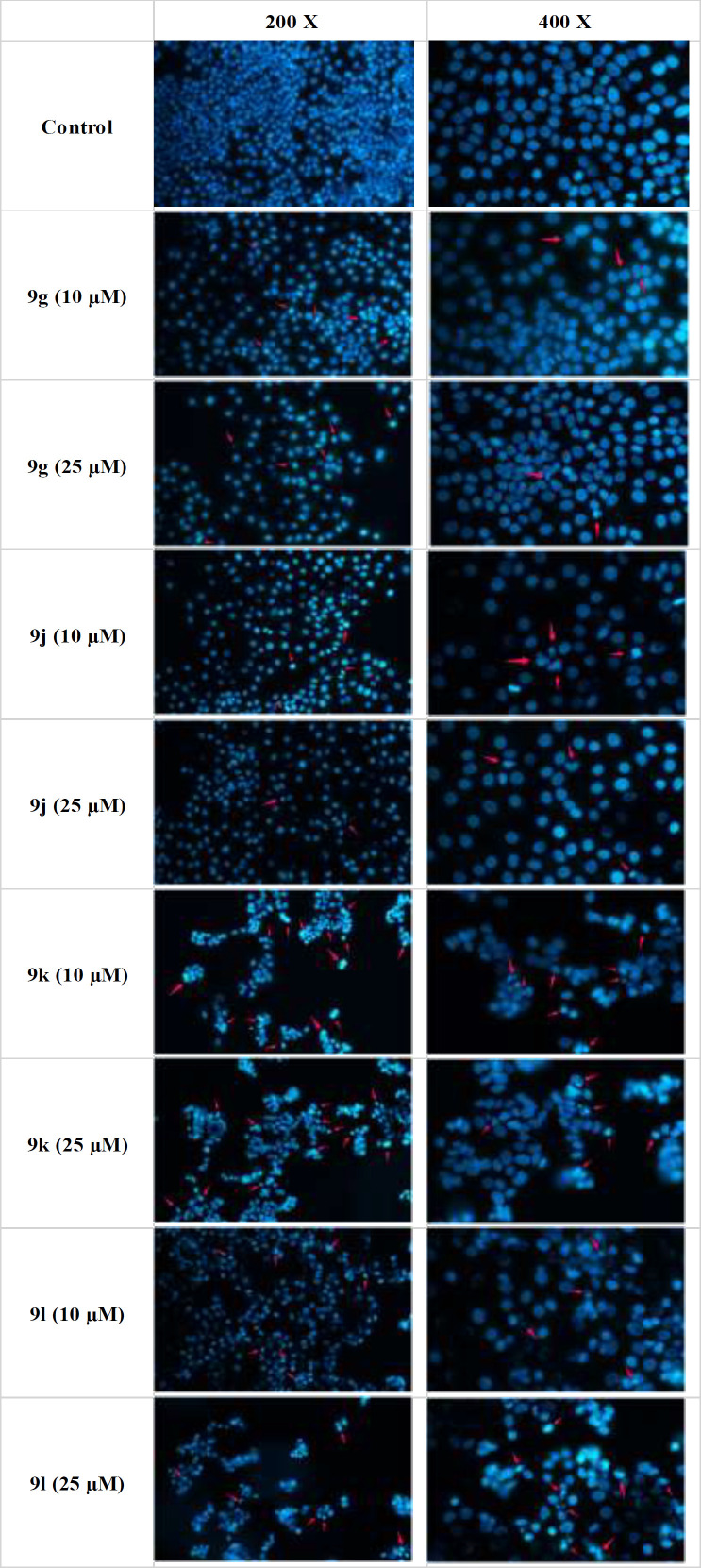 Detection of apoptosis in MCF-7 cells by Hoechst staining. Hoechst 33258 was used as a DNA stain to detect apoptosis in MCF-7 cells treated with synthesized compounds. The cells were seeded in a 6-well plates and treated with different concentrations of test compounds 9g, 9j, 9k and 9l for 72 h. After removing the whole medium, 4% cold freshly prepared paraformaldehyde (PFA) was added for 20 min at room temperature, the cells were then washed twice with PBS, and incubated with Hoechst 33258 2.5 µg/mL for 30 min at room temperature in the dark. Finally, the cells were washed with PBS again and the plates were imaged with a fluorescence microscope