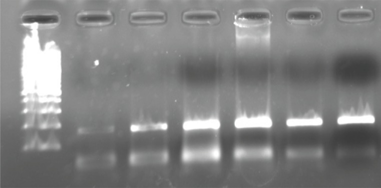 100 bp Molecular ladder is on the left side. PCR product bands stand at 168 bp