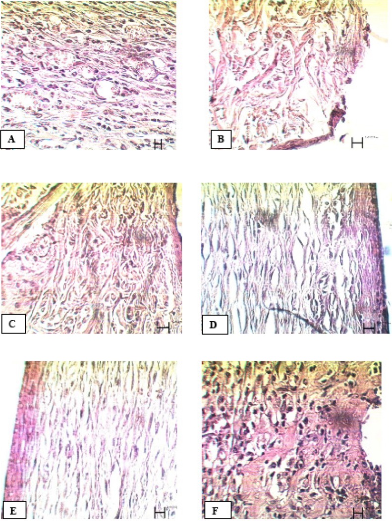 Microscopic panel of wounds on the 21st day of treatment in rats. A) Control skin: new epithelial layer is forming. There is a reduction in wound size. Congestion of inflammatory cells is reduced. B) Tetracycline treated skin: Epithelial is formed but epithelial layers are not yet complete. A large number of fibroblasts and abnormal density of collagen fibers in the dermis are evident. C) Alpha treated skin: Epithelial layer is formed but it is not yet complete. Collagen fibers, blood capillaries, hair follicles and sebaceous glands are evident in the dermis with normal density. D) PHP 40% treated skin: the epidermis, except the horny layer, is formed. Epidermis, hair follicles and sebaceous glands are observed as normal. A normal density of collagen fibers and a normal distribution of connective tissue in the dermis are seen. E) PHP 10% treated skin: Complete formation of the epidermis, except horny layer; high density of blood capillaries in the dermis is seen. In view of the dermis, collagen fibers and connective tissue are completely normal. F) Paste base treated skin: Epithelial layer is formed, but not completely. Low density of fibroblasts and low density of blood capillaries are seen. PHP; poly herbal paste. ×400