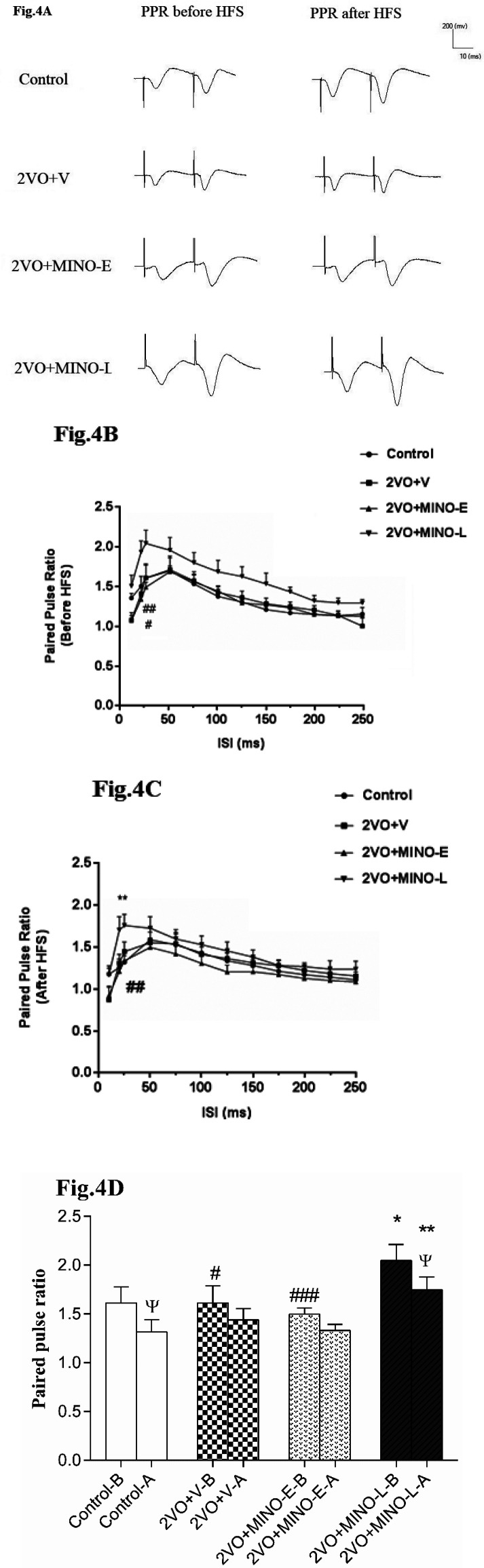 The effect of MINO administration on the PPR (fEPSP2/fEPSP1) in hypoperfused rats. (A)The sample traces are presented for ISI 25 ms in before and after HFS stimulation. (B and C) The linear graph shows the PPR change at ISI 20–250 ms before and after HFS. (D)The Paired-T test comparison of PPR before and after HFS for ISI 25 ms. Values shown as means ± SEM, significant differences with respect to the control (*P < 0.05, **P < 0.01) and 2VO+MINO-L (#P < 0.05, ##P < 0.01 and ###P < 0.001) groups. Significant difference before and after HFS ΨP < 0.05