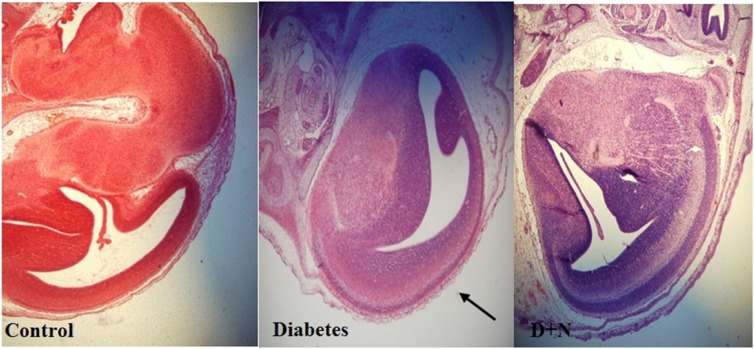 Comparison of the cerebral cortex in embryo of control, diabetic and D + N (Diabetic mice that received Nanoceria) group (200 x).