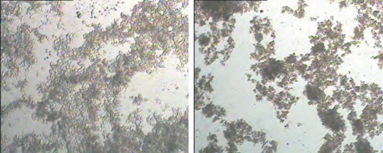 Light microscopic images of I (a) and 8I (b) treatments. The samples were not homogenized with homogenizer and were only uniformly agitated before analysis