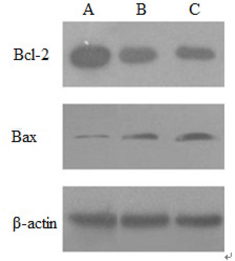 Expression of Bcl-2 and Bax protein induced by baicalin in HeLa cells.(A) control group, (B) low dose group, (C) high dose group