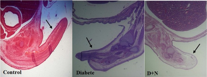 The tail has been found necrotic in the diabetic group compared with control and D + N (Diabetic mice that received Nanoceria) (200 x).