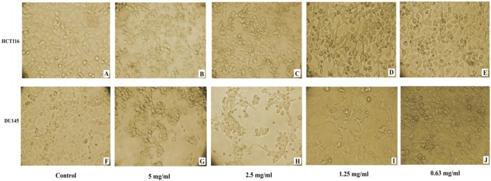 Induced cytotoxic effect in HCT116 and DU145 cancer cells 24 h post captopril treatment with different concentrations. (A and F): untreated control HCT116 and DU145; (B and G): HCT116 and DU145 cells treated with 5 mg/mL; (C and H): HCT116 and DU145 cells treated with 2.5 mg/mL; (D and I): HCT116 and DU145 cells treated with 1.25 mg/mL; (E and J): HCT116 and DU145 cells treated with 0.63 mg/mL respectively. A distinct cytotoxic effect of captopril was obvious where the cells became more dense and granulated along with increasing drug concentration