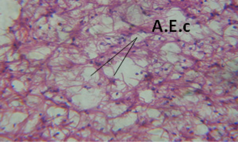 T.S. in treated B. alexandrina with 20 ppm fruits extract showing digestive epithelia. A.E.c: evacuated epithelial cells X = 200