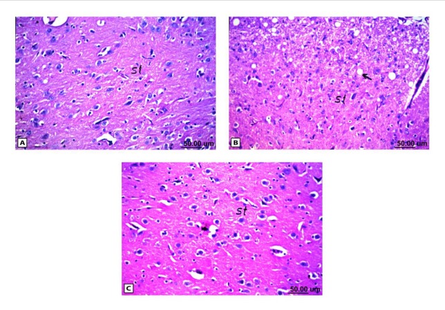 Histopathological results of rat brain area of striatum (st). (A) Normal control group: normal structure of striatum (st). (B) Rat administered AlCl3: vacuolization in the matrix of striatum (arrow). (C) Rat treated with i.v. nano-HAp after AlCl3: Normal structure of striatum (st)