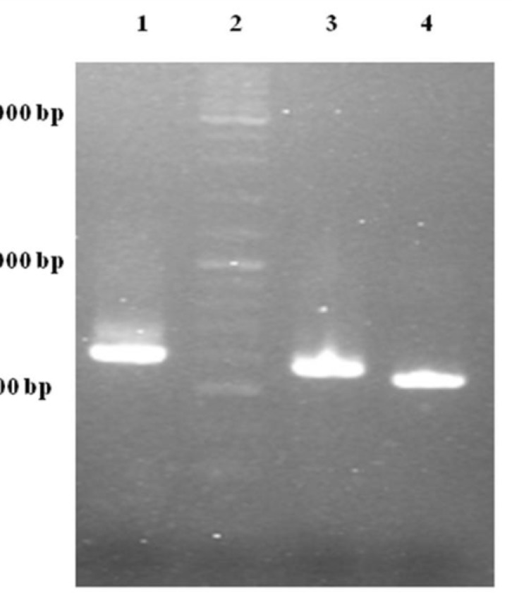 Gel electrophoresis analysis of OE-PCR products. Lane 1: 594 bp product amplified with F2R primer indicating OmpA-TRAIL whole sequence. Lane 2: DNA Ladder marker. Lane 3: 557 bp product amplified with F1R primer indicating partially-synthesized signal sequence. Lane 4: 504 bp product amplified with TRAIL specific primers indicating TRAIL sequence.
