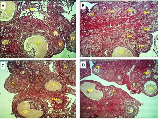 Ovarian structure in different groups (H&E, ×4). Normal rats showed developing ovarian follicles in different stages (A), HFD diabetic rats showed more preantral and antral atretic follicles (B). A. esculentus and Metformin treated rats (C and D) showed decreased number of preantral and antral atretic follicles and increased the number of antral follicles and growing CL. SF: secondary follicle, TF: tertiary follicle, G:graafian follicle, PAA: preantral atretic and AA: antral atretic follicles, CL: corpus luteum, M: medulla