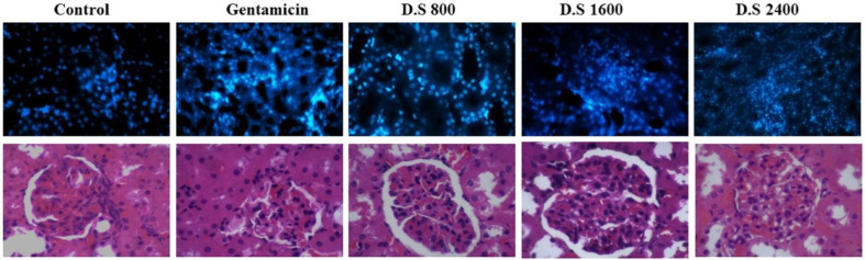 H and E tissue staining and scoring of kidney tissues. At the end of study, the animals were sacrificed and kidney tissues were evaluated for the percent of damaged cells. The study groups included control, and four experimental groups. Group 1 received normal saline + gentamycin treatment. The three other experimental groups received Descurainia sophia extract (Group 2: 800 mg/Kg; Group 3: 1600 mg/Kg; and Group 4: 2400 mg/Kg). Analysis of variances showed that there was a significant difference in the percentage of damaged cells between the groups (p-value< 0.000). HSD-Tukey test, for separate comparisons, also showed significant differences between groups (p-value< 0.05 for each double comparisons).
