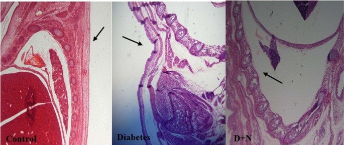 The spine has been found niche in the diabetic group compared with control and D + N (Diabetic mice that received Nanoceria) (200 x).