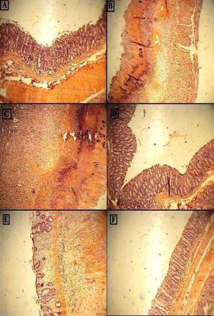 Photomicrographs of H&E stained paraffin sections of rat colonic tissues; (A) Normal intact mucosa from normal control animals showed intact epithelial surface. (B) Colitis induced by acetic acid in control group; Crypt damage, mucosal layers destruction and leukocyte infiltration are evident; (C) acetic acid-induced colitis in reserpine induced (6 mg/kg, i.p.) depressed rat showing massive necrotic destruction of epithelium; D, E and FColitis tissue treated with dexamethasone (1 mg/kg, i.p.), amitriptyline (10 mg/kg, i.p.), amitriptyline (20 mg/kg, i.p.) respectively, showing attenuated the extent and severity of the histological signs of cell damage;i.p. =intraperitoneally; Original Magnification×10
