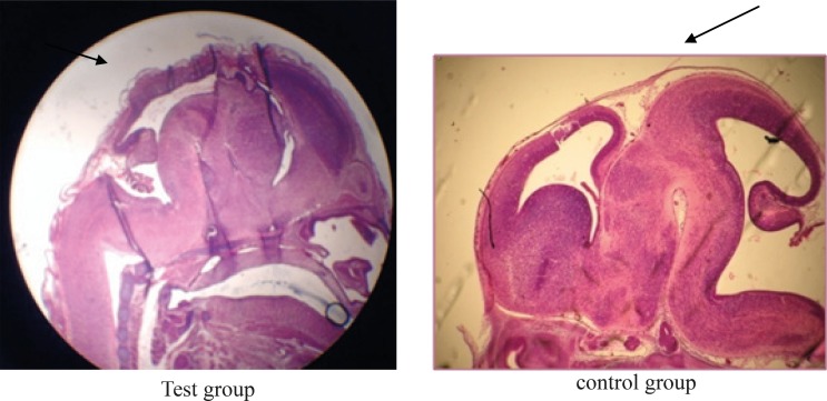 Comparison of the curves in the cerebral cortex of fetuses in test and control groups.